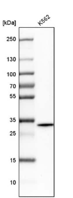 RHBDD1 Antibody, Novus Biologicals:Antibodies:Primary Antibodies